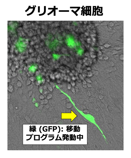 脳腫瘍細胞に至ってはこの移動様式を利用して脳内を這い回る