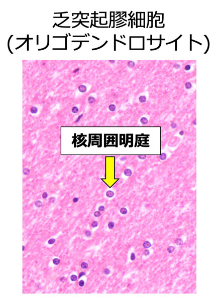 オリゴデンドロサイト